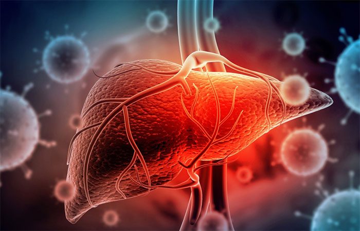 Most hepatitis B cases are detected after progressing to cirrhosis or cancer.