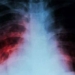 who warns of a disease that has killed more than covid 19 after 20 years 126547