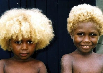 why are there people who naturally have blonde hair 125570