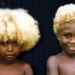 why are there people who naturally have blonde hair 125570