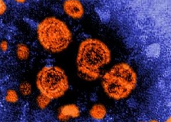 5 theories on the causes of mysterious liver inflammation disease 120466