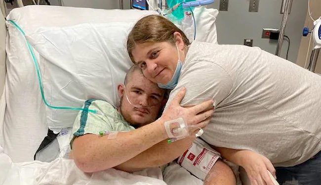 This young man survived after encountering a hive of African killer bees.