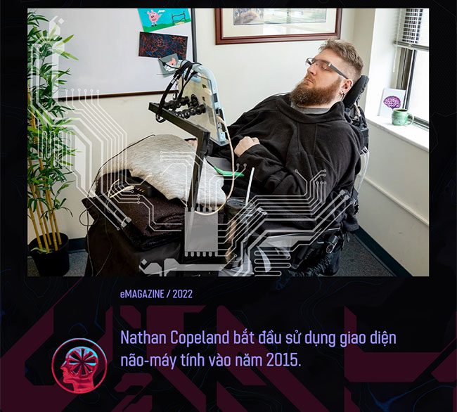 Copeland's implant is still functioning without complications