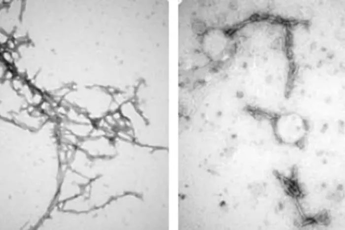 PFFNB2 tightly binds to protein aggregates, effectively breaking them apart.