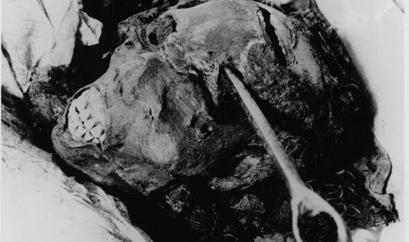 Horrific wounds on the face and forehead.