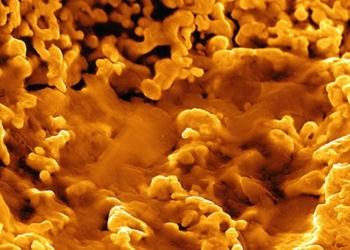 bacteria discovered in 1976 can transform metal into gold 124365