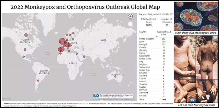 Monkeypox shows no signs of stopping.