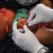 bcg vaccine type vaccine preventing new mouth disease 122444