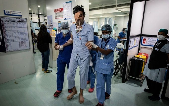 Patient Vikram Trivedi had to undergo the removal of his left eyeball and throat.