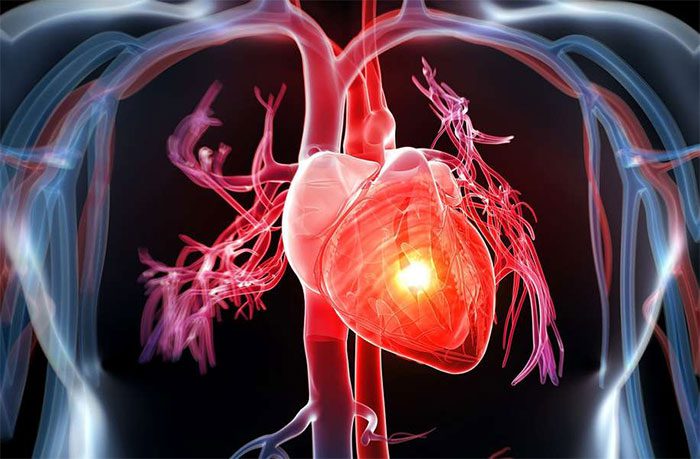 Heart failure is a weakening of the heart, unable to receive and pump blood to nourish the body.
