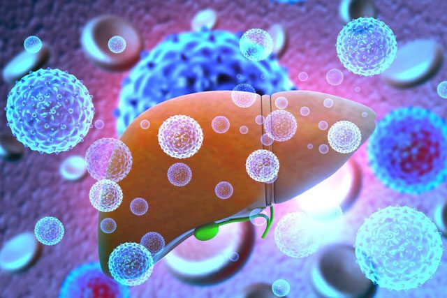 3D illustration showing a liver infected with hepatitis virus.
