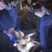 big question after first heart transplant for person 122217