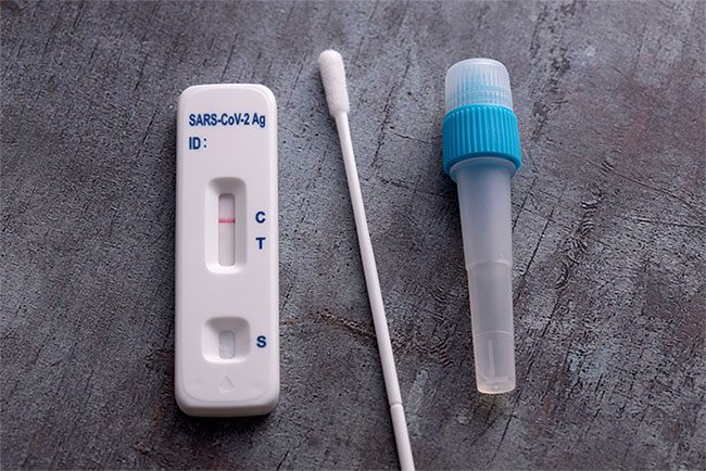 bo test nhanh covid 19