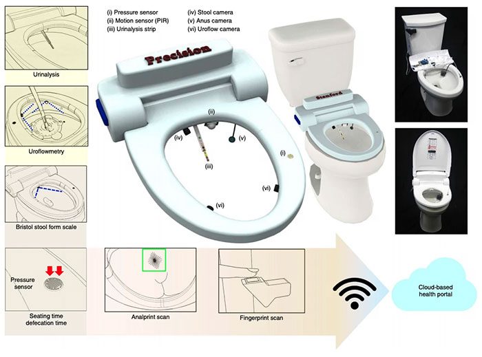 Toilet equipped with a camera and machine learning algorithms.