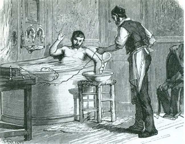 French-style electric bathtub from the late 1870s.