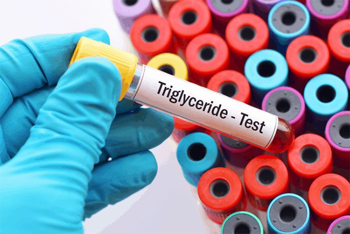 Triglyceride testing can indicate inflammation in the pancreas