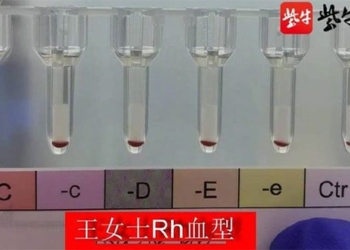 china discovers 2 women with the rarest blood type in the world 122746