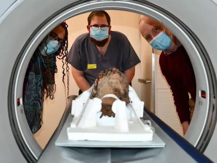 Scientists beside the human head being scanned