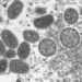 common virus winter air in india different from common in europe 122066