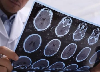 continuous impact on pain causing more than 122829