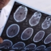 continuous impact on pain causing more than 122829