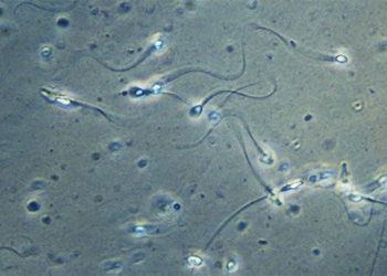 covid 19 reduces quantity and quality of sperm but does not affect fertility 118018