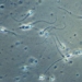 covid 19 reduces quantity and quality of sperm but does not affect fertility 118018