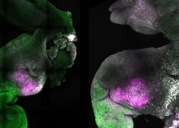 creating a comprehensive mouse model that develops brain and heart responds 122671