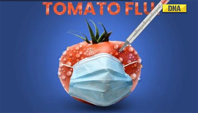 Tomato Flu has some atypical manifestations.
