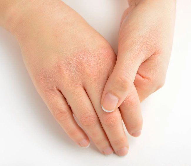 Thickened, Rough Skin