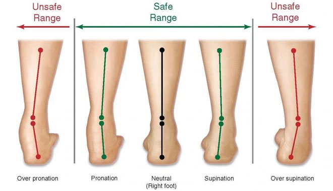 One of the most common injuries in running is ankle sprains (pronation).
