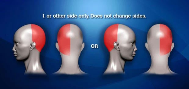 There are hundreds of different types of headaches.