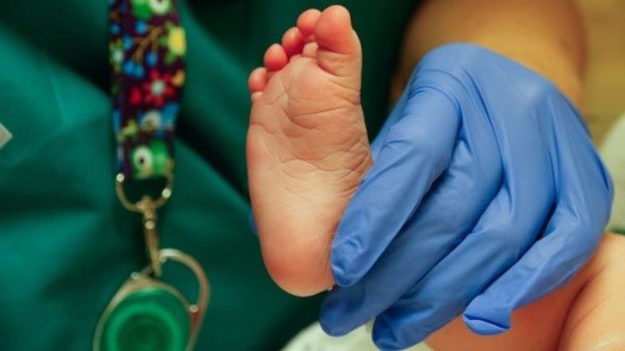 Newborns have less distinct fingerprints compared to footprints, making footprints easier to identify.