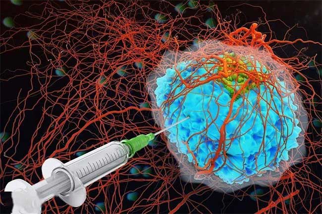 Illustration of cancer treatment using hydrogel