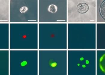 discovery of a previously unknown thing in the human lung that can transform into anything 119828
