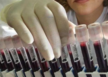 discovery of new blood type named super model 123402