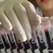 discovery of new blood type named super model 123402