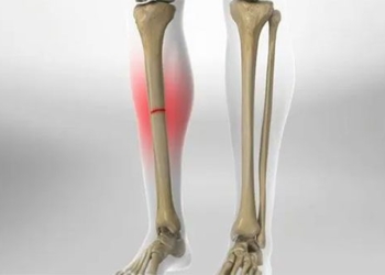 discovery of stem cells help repair bone injuries 123848