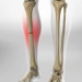 discovery of stem cells help repair bone injuries 123848