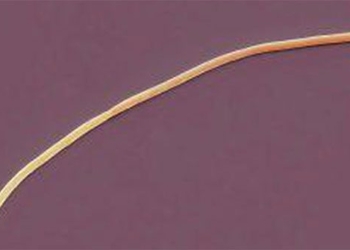 discovery of the largest bacteria species ever 119058