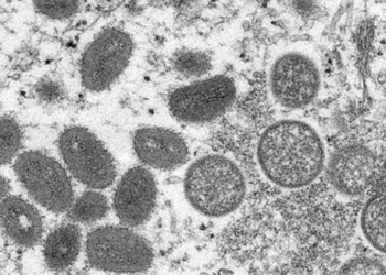 disease of the rainy season in europe 120599