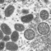 disease of the rainy season in europe 120599