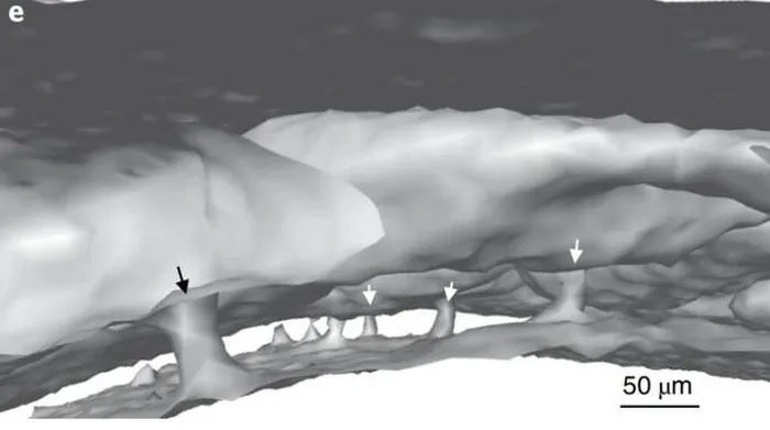 Tunnel-like channels transporting immune cells in the human brain.