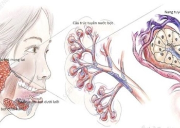 early signs of pancreatic cancer 121094