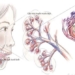 early signs of pancreatic cancer 121094