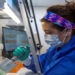 explaining the reasons for omicron variant symptoms being milder than delta variant 118073