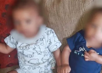 extraordinary unique twin boys born with mother but different 123010