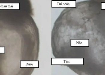 first fetus created without in vitro fertilization and implantation 122156