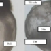 first fetus created without in vitro fertilization and implantation 122156