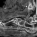 first time discovery of injury on mummy body in egypt 118342